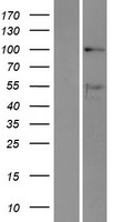 DDX10 Human Over-expression Lysate