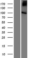 SLC9A5 Human Over-expression Lysate