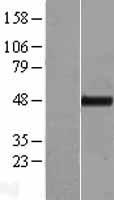 TTC4 Human Over-expression Lysate
