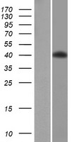 PCYT1B Human Over-expression Lysate
