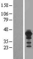 HOMER3 Human Over-expression Lysate