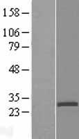 C1orf38 (THEMIS2) Human Over-expression Lysate