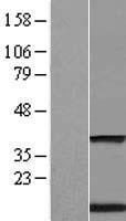 TMEM59 Human Over-expression Lysate