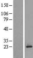 MPDU1 Human Over-expression Lysate