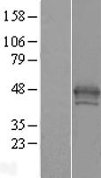 MACROH2A1 Human Over-expression Lysate
