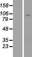 CLOCK Human Over-expression Lysate