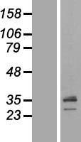 SCAMP1 Human Over-expression Lysate