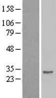 IER2 Human Over-expression Lysate