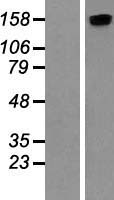 ROCK2 Human Over-expression Lysate