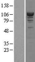 alpha Actinin 4 (ACTN4) Human Over-expression Lysate
