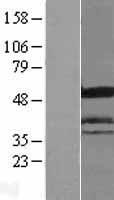 ICA1 Human Over-expression Lysate