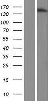 JARID2 Human Over-expression Lysate
