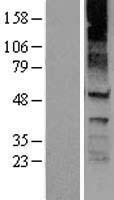 KCNJ8 Human Over-expression Lysate