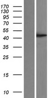 PGGT1B Human Over-expression Lysate
