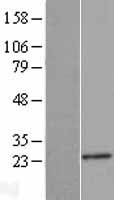 NDUFB9 Human Over-expression Lysate