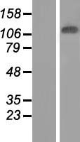 JMJD7-PLA2G4B Human Over-expression Lysate