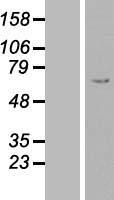 Fibrinogen beta chain (FGB) Human Over-expression Lysate