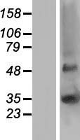 GJB5 Human Over-expression Lysate