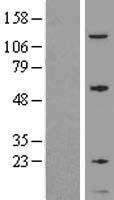 GNG5 Human Over-expression Lysate