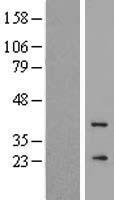 GCAP3 (GUCA1C) Human Over-expression Lysate