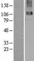 GABA B Receptor 2 (GABBR2) Human Over-expression Lysate