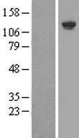 SHIP (INPP5D) Human Over-expression Lysate