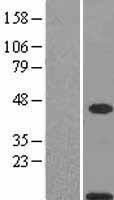 S100A11 Human Over-expression Lysate