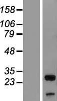 UBXN8 Human Over-expression Lysate
