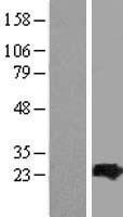 ARL4C Human Over-expression Lysate
