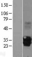 EVA1 (MPZL2) Human Over-expression Lysate