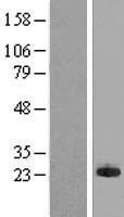 MPP6 (MPHOSPH6) Human Over-expression Lysate