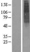ALG3 Human Over-expression Lysate