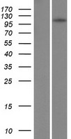 TSHZ1 Human Over-expression Lysate