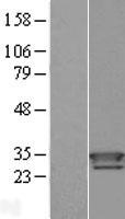 Thioredoxin domain containing 9 (TXNDC9) Human Over-expression Lysate