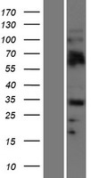 OLIG2 Human Over-expression Lysate