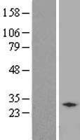 DSCR1L1 (RCAN2) Human Over-expression Lysate