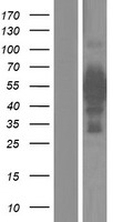 IRX5 Human Over-expression Lysate