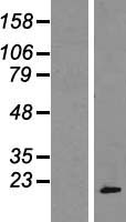 RPP20 (POP7) Human Over-expression Lysate