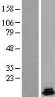 HRSP12 (RIDA) Human Over-expression Lysate