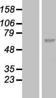 Calicin (CCIN) Human Over-expression Lysate
