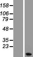 MT1F Human Over-expression Lysate