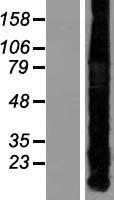 Metallothionein (MT1A) Human Over-expression Lysate
