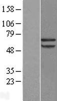 Papillary renal cell carcinoma (PRCC) Human Over-expression Lysate