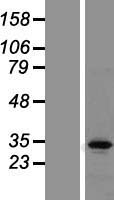 TRAX (TSNAX) Human Over-expression Lysate