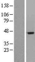 IL20 Receptor alpha (IL20RA) Human Over-expression Lysate