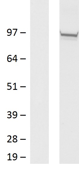 Eph receptor B2 (EPHB2) Human Over-expression Lysate