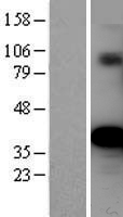 Ornithine Carbamoyltransferase (OTC) Human Over-expression Lysate