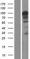 FAM193B Human Over-expression Lysate