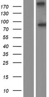 ODF2 Human Over-expression Lysate