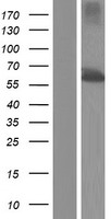 TBC1D24 Human Over-expression Lysate